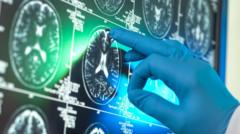 Report suggests 'breakthrough' Alzheimer's drugs unlikely to benefit patients