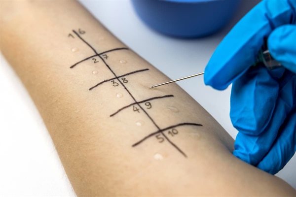 Why Should You Visit an Allergist