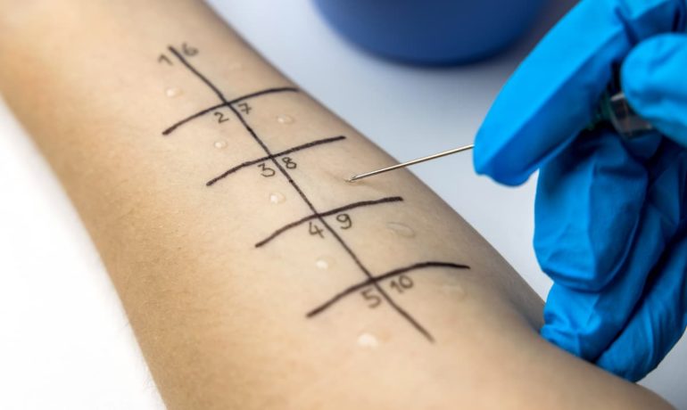 Why Should You Visit an Allergist